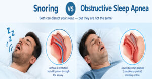 Snoring Vs. Obstructive Sleep Apnea